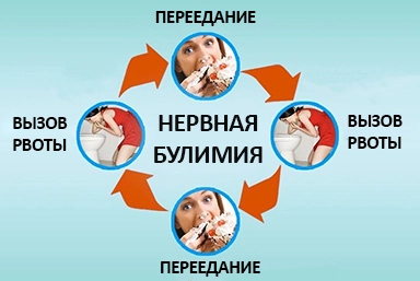 Лечение булимии в городе Шилка
